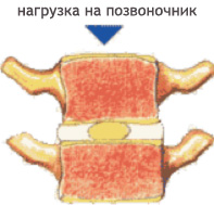 Амортизирующая функция межпозвоночного диска Амортизирующая функция межпозвоночного диска.